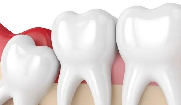 Usuwanie ósemek - na czym polega?