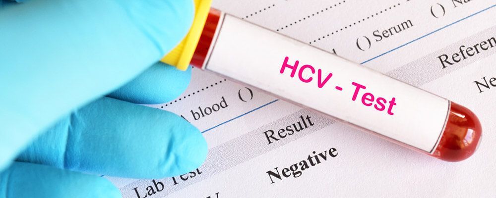 hcv